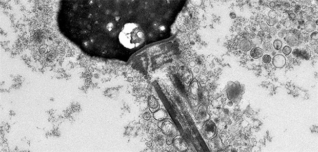 Warum nur die fittesten Spermien weiter kommen Die elektronenmikroskopische Aufnahme zeigt ein Spermium mit angelagertem Amyloid.