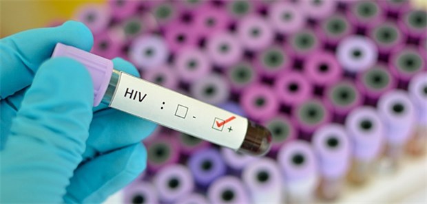 HIV-Test bei Frauen oft zu spät Die frühe Erkennung von HIV durch einen Test ist ein essenzieller Schritt für eine wirksame HIV-Therapie.