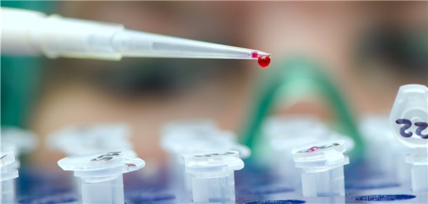 Die funktionelle Aktivität des hoch kreuzreaktiven Autoantikörpers ACPA sollte weiter erforscht werden.