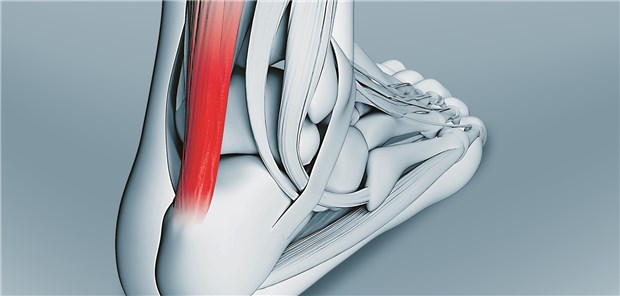 Die geheilten Achillessehnen waren nach früher Belastung um 18mm verlängert.