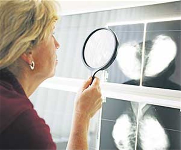 Die hohe Spezialisierung der Ärzte in Brustzentren führt zu einer besseren Behandlung der Patientinnen.