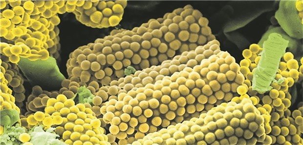 "Nano-Mais" bringt Wirkstoff in die Lunge Die in der Aufnahme gelb und grün gefärbten, zylinderförmigen Wirkstoff-Transporter sehen mit ihrer noppigen Struktur aus wie Mais.