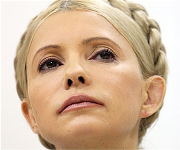 Deutsche Ärzte übergeben Timoschenko-Diagnose Die inhaftierte ukrainische Ex-Regierungschefin Julia Timoschenko bestand auf einer Behandlung durch angereiste deutsche Ärzte.