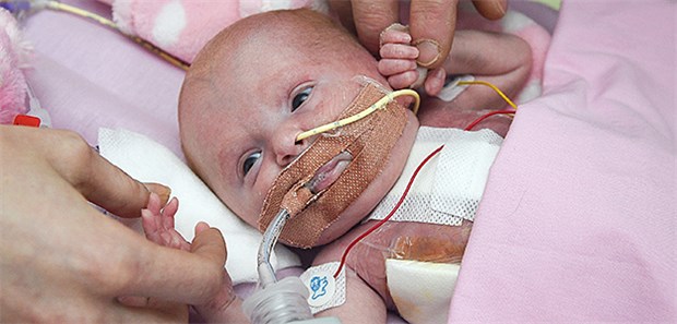 Britisches Baby mit außen liegendem Herzen geboren Die kleine Vanellope Hope Wilkins kam mit dem Syndrom Ectopia cordis auf die Welt.