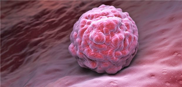 Menschliche Embryomodelle im Labor gezüchtet Die künstlich hergestellten Blastoide ähneln humanen Blastozysten.