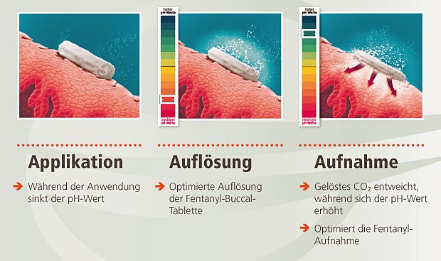 Die lokalen pH-Wert-Veränderungen an der Wangenschleimhaut durch die bei den Buccaltabletten genutzte OraVescent®-Technologie sind der Schlüssel für die optimierte Resorption von Fentanyl.