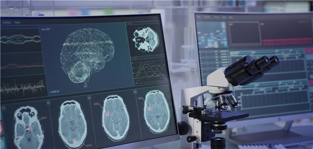 Die neue Klassifikationsmethode mit der Bezeichnung SynNeurGe konzentriert sich zum einen auf den wichtigsten molekularen Biomarker, aggregiertes Alpha-Synuclein, zum anderen auf den Nachweis einer Neurodegeneration sowie der Präsenz pathogener Mutationen oder Genvarianten. 