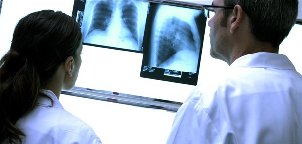 Zwei Ärzte schauen sich zwei Röntgenaufnahmen eines Thorax an.