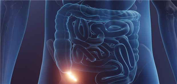 Schaubild des Darms. Der Blinddarm ist markiert. 