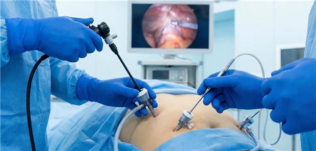 Aufnahme einer Laparoskopie mit Trokaren bei einem Patienten im Operationssaal