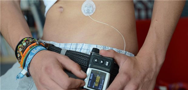 Junger Mann stellt seine Insulinpumpe ein.