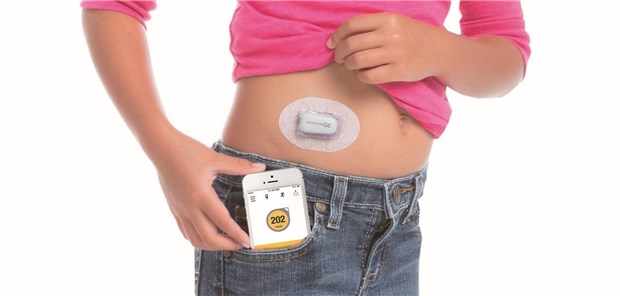 Die sensorbasierte Blutzuckermessung erfreut sich beiDiabetikern einer immergrößeren Beliebtheit.