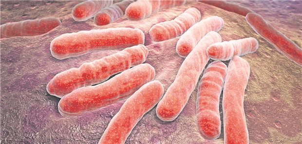 Die spezifische Transkriptionssignatur dreier Gene von Mycobacterium tuberculosis, dem Erreger von Tuberkulose, kann wohl für die Diagnose von Tuberkulose bei Kindern genutzt werden.