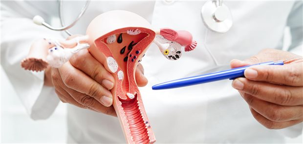 Arzt hält Anatomiemodell des weiblichen Uterus für die Erklärung von Diagnosen und Behandlungen im Krankenhaus.