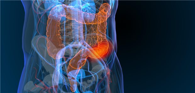 Die vom Gastroenterologen Joshua Demb angeführte Arbeitsgruppe resümiert, dass die Befunde ihrer Studie, zusammen mit dem steigenden Risiko für Darmkrebs von Menschen im Alter von unter 50, die dringende Notwendigkeit, Ärzte und Patienten über die genannten Zeichen und Symptome zu unterrichten unterstreichen.