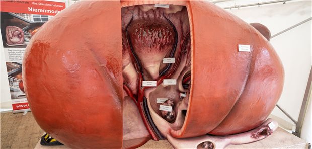 Modell einer Niere