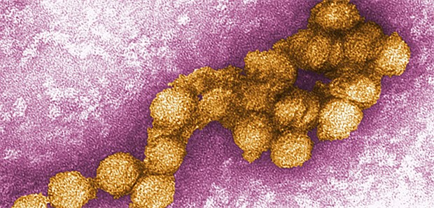 Dritter West-Nil-Virus-Fall in Deutschland Dieses von den Centers for Disease Control zur Verfügung gestellte Foto aus dem Jahr 2012 zeigt eine elektronenmikroskopische Aufnahme des West-Nil-Virus.