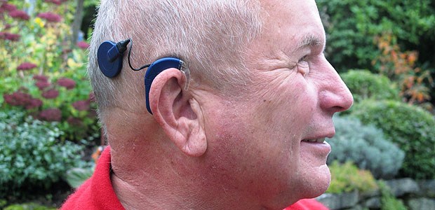 Mit Cochlea-Implantat endlich wieder hören Dieter Schmitz mit seiner elektronischen Hörprothese: Für das Cochlea-Implantat (CI) wird hinter der Ohrmuschel ein Elektrodenträger in das Innenohr eingesetzt.