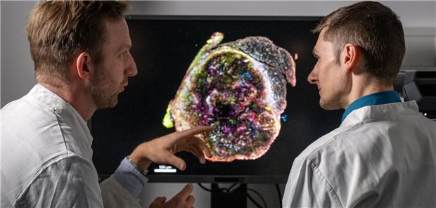 Dr. Jan Böttcher, Gruppenleiter und TUM Junior Fellow am Instiut für Molekulare Immunologie, am Klinikum Rechts der Isar (l.) und Doktorand Sebastian Lacher vor einer Immunfluoreszenz-Mikroskopieaufnahme eines Tumors, in der tumor-infiltrierende Immunzellen zu sehen sind.