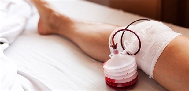 Was Ist Eine Drainage Medizin www.aerztezeitung.de