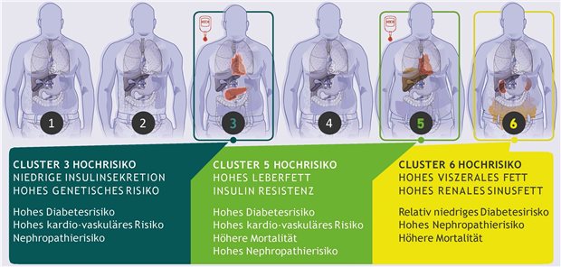 Drei der sechs Subtypen unterscheiden sich deutlich bei den Risiken für Krankheitsentstehung und Folgekrankheiten.