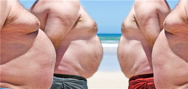 Dringender Handlungsbedarf: Ein solches Ausmaß an viszeralem Fettgewebe ist ein großes gesundheitliches Problem und kostet Lebensjahre!