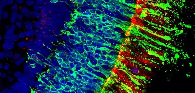Wissenschaftler züchten menschliche Netzhaut Dünnschnitt durch ein gezüchtetes Netzhaut-Organoid unter dem Mikroskop.