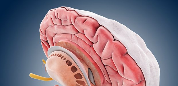 Oft stoppt ein Miniloch den Kopfschmerz Dura mater im Blick: Bei größeren Subduralhämatomen hilft ein Miniloch in der Schädeldecke.