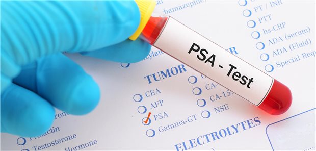 Test-Röhrchen, auf dem PSA-Test draufsteht.
