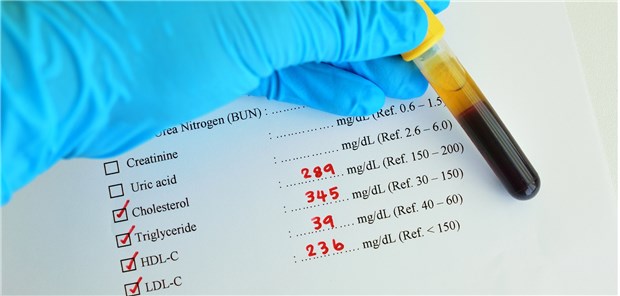 Dyslipidämie – Die Risikobeurteilung soll künftig noch stärker personalisiert werden.