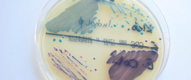Deutschland glänzt nicht bei Klinikhygiene E. coli und K. pneumoniae: Risikokeime für das Krankenhaus.