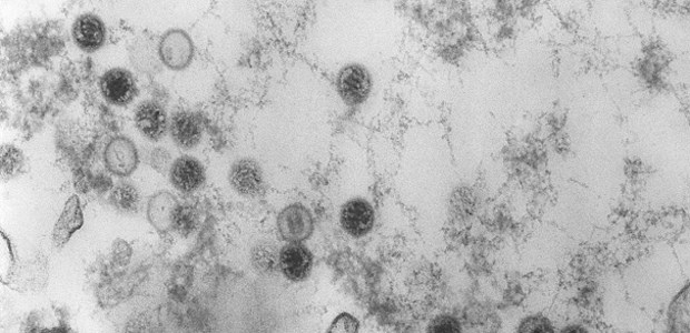Ganciclovir schützt Kinder vor Krebs EBV unter dem Elektronenmikroskop: Ganciclovir soll die Viren in Schach halten.