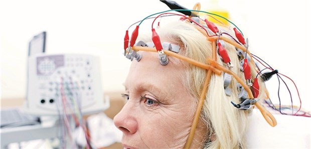 EEG bei einer Epilepsie-Patientin.