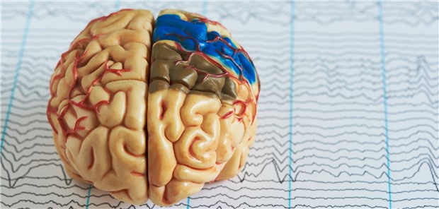 EEG eines Epilepsiepatienten: Mit guter Anfallskontrolle lässt sich ein SUDEP vermeiden.