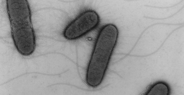 E. coli - nicht nur ein harmloser Schmarotzer EHEC unter dem Elektronenmikroskop: Die kleinen Stäbchen befallen derzeit etliche Menschen im Land.