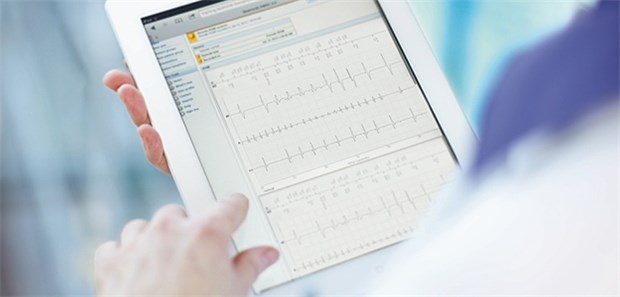 EKG-Analyse: Besteht Vorhofflimmern? Wie hoch ist das Risiko für einen Schlaganfall?