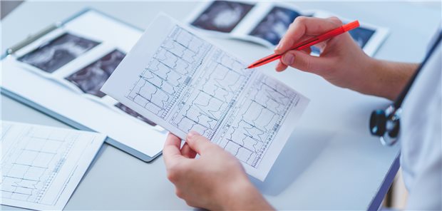 EKG-Check: Eine Ruhetachykardie kann ein Hinweis auf eine kardiovaskuläre autonome Neuropathie sein.