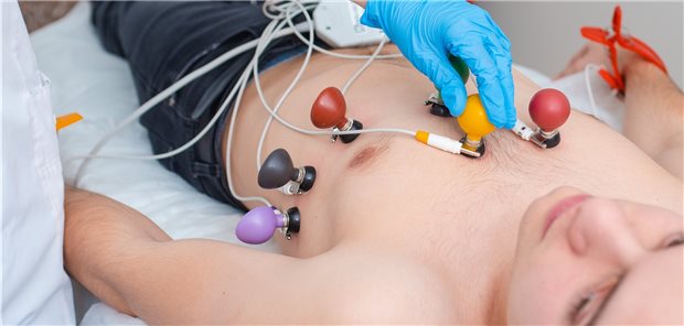 EKG: Hat dieser junge Patient ein Vorhofflimmern? Fast jeder fünfte Betroffene in dieser Altersgruppe wies in einer US-Studie eine pathologische oder wahrscheinlich pathologische Genvariante auf.