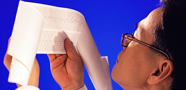 Betablocker verlängert Leben nach Herzinfarkt EKG-Kontrolle. Bekommen COPD-Patienten nach Herzinfarkt immer die indizierte Arznei?