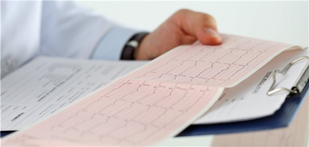 EKG-Kontrolle. Ist das Problem „Vorhofflimmern“ beseitigt?