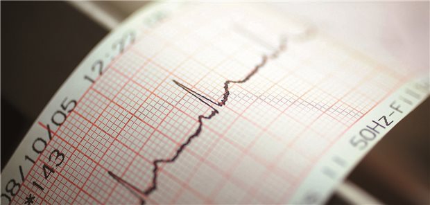 EKG-Kontrolle bei Vorhofflimmern (VHF): Die europäischen Leitlinien zum Management bei VHF sind aktualisiert worden.