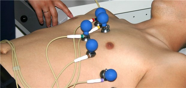 EKG: Über 10 Prozent der Lungenemboliepatienten hatten in einer Studie Vorhofflimmern.
