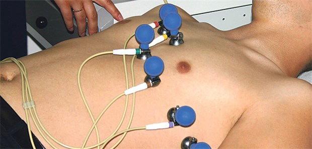 Heute früher erkannt, erfolgreicher behandelt EKG-Untersuchung: Hat dieser Patient ein Vorhofflimmern ?