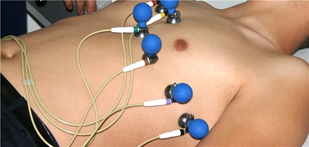 EKG-Untersuchung: Welche Therapie kommt im Falle eines Vorhofflimmerns in Frage?