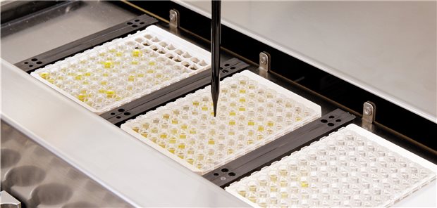 Antikörpertest auf SARS-CoV-2 entwickelt ELISA (Enzyme Linked Immunosorbent Assay)-Test: Befinden sich in einer Probe Antikörper auf ein bestimmtest Virus, zeigt sich das durch einen Farbumschwung (Symbolbild).