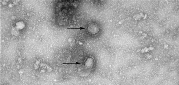 Neues Coronavirus ähnelt SARS-Viren aus Fledermäusen EM-Aufnahme des neuen Coronavirus, das in der chinesischen Stadt Wuhan wohl für die mysteriöse Lungenkrankheit verantwortlich ist.