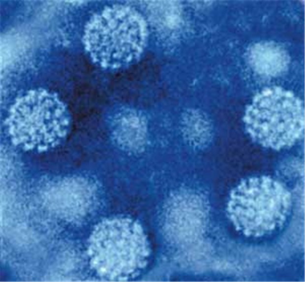Mit HPV-Test gibt es weniger Zervixkarzinome EM-Aufnahme von Papillomviren. Krebsauslösend sind vor allem HPV-Typ 16 und 18.