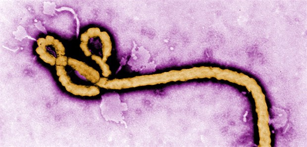 Bald RNA-Therapie gegen Ebola? Ebola-Virus: Rücken siRNA-Therapien den Filoviren bald zu Leibe?