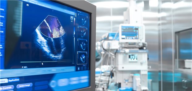 Echokardiografie: Häufig haben Patienten mit einem Schlaganfall unklarer Ätiologie als Zufallsbefund ein persistierendes Foramen ovale.