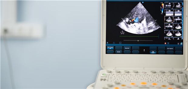 Echokardiografie mit Dopplerfunktion: Bei schwerer COVID-19 wurde damit in einer Studie oft eine Dilatation des rechten Ventrikels gefunden.